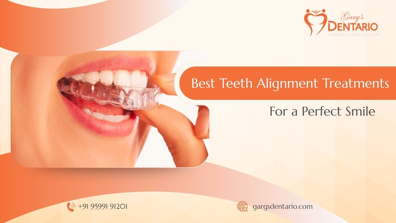 Best Teeth Alignment Treatments for a Perfect Smile